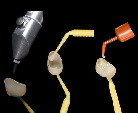 3MOCSD_Blog_Round13_Arcara_RelyXUniversal_560x460_10