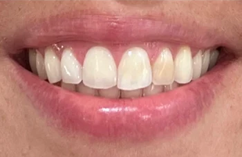 Ultradent- image 1-1