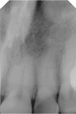 Ultradent- image 2